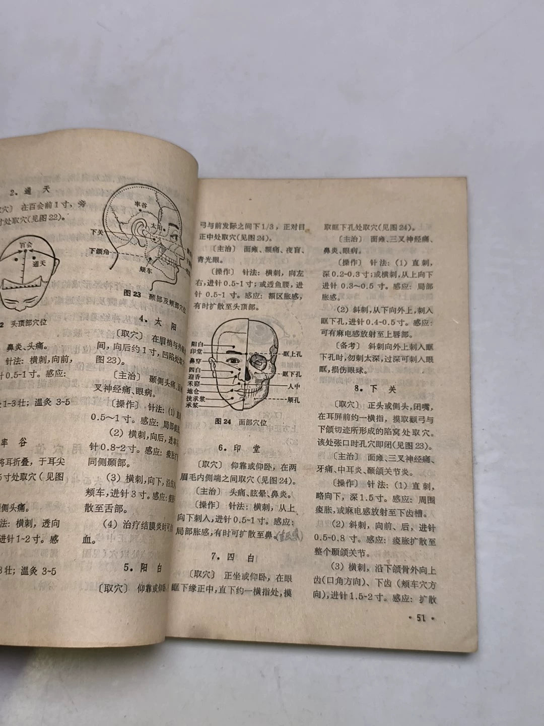 Acupuncture Treatment Handbook – 1970 Chinese Edition – photo 8